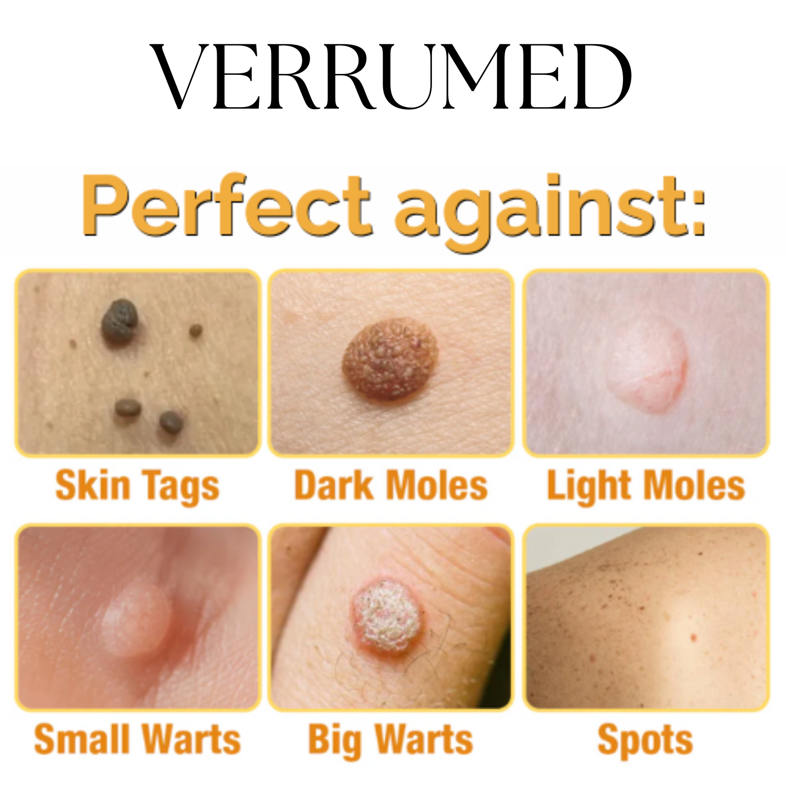 VERRUMED-1-1.png